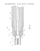 PROFILE REDUCTION OF VALVE IMPLANT diagram and image