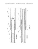 PROFILE REDUCTION OF VALVE IMPLANT diagram and image