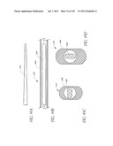 PROFILE REDUCTION OF VALVE IMPLANT diagram and image