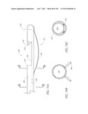 PROFILE REDUCTION OF VALVE IMPLANT diagram and image