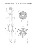 PROFILE REDUCTION OF VALVE IMPLANT diagram and image