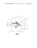 SPINAL IMPLANT CONFIGURED FOR LATERAL INSERTION diagram and image