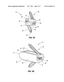SPINAL IMPLANT CONFIGURED FOR LATERAL INSERTION diagram and image