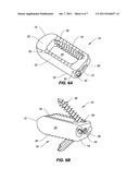 SPINAL IMPLANT CONFIGURED FOR LATERAL INSERTION diagram and image