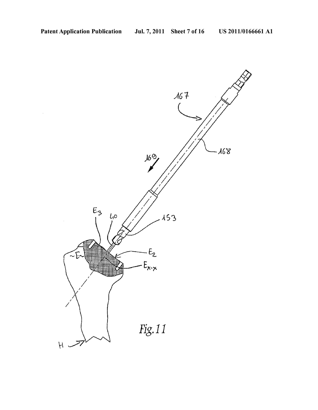 APPARATUS FOR FITTING A SHOULDER PROSTHESIS - diagram, schematic, and image 08