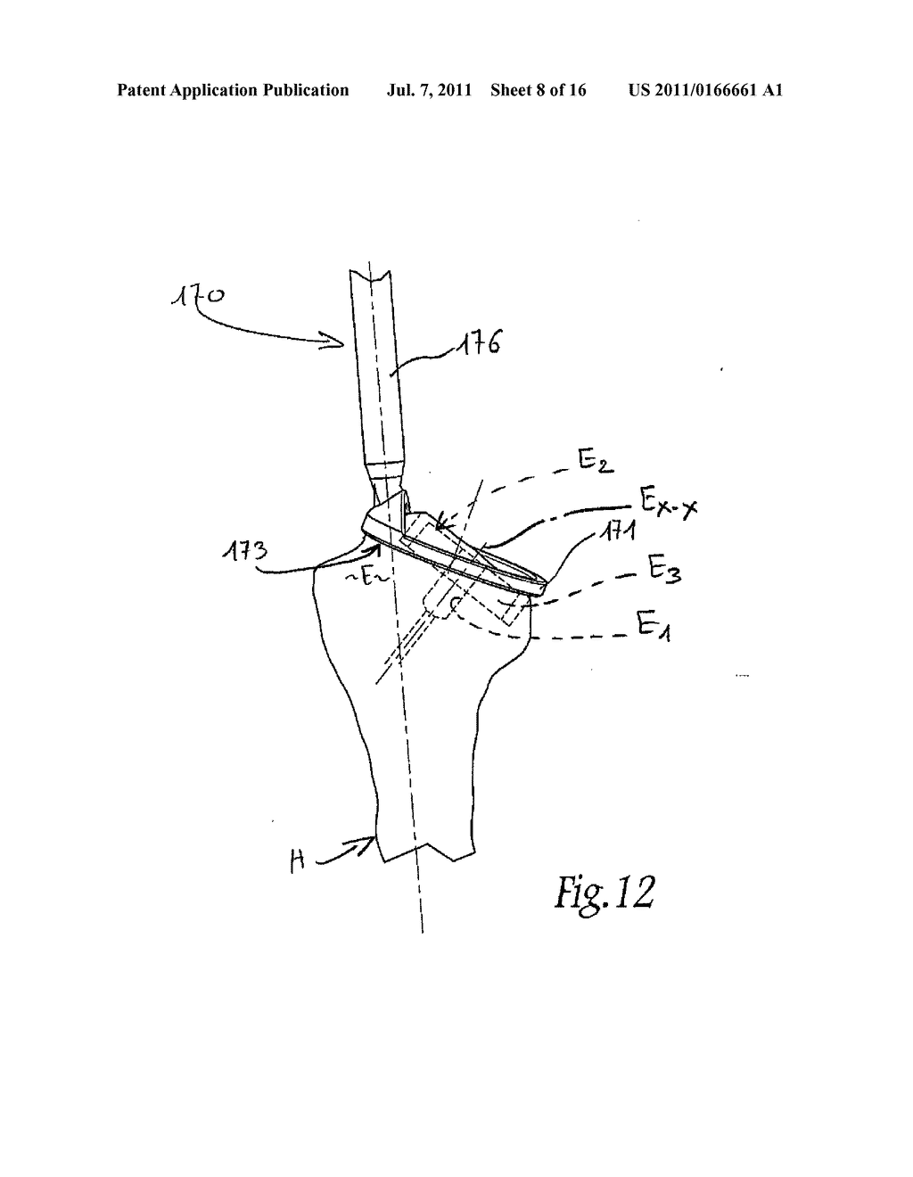 APPARATUS FOR FITTING A SHOULDER PROSTHESIS - diagram, schematic, and image 09