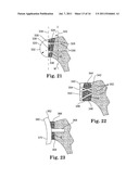 APPARATUS FOR FITTING A SHOULDER PROSTHESIS diagram and image