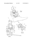 ANKLE PROSTHESIS diagram and image