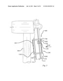 METHOD OF REPAIRING A WIND TURBINE BLADE diagram and image