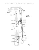 METHOD OF REPAIRING A WIND TURBINE BLADE diagram and image