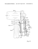 METHOD OF REPAIRING A WIND TURBINE BLADE diagram and image