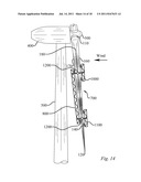 METHOD OF REPAIRING A WIND TURBINE BLADE diagram and image