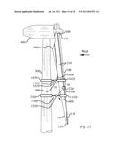 METHOD OF REPAIRING A WIND TURBINE BLADE diagram and image