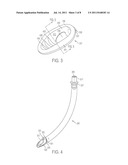 Self-Pressurizing Supraglottic Airway diagram and image