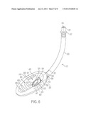 Self-Pressurizing Supraglottic Airway diagram and image