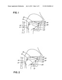 INTRA-ORAL APPLIANCE FOR TREATMENT OF SLEEP DISORDERS diagram and image