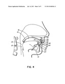 INTRA-ORAL APPLIANCE FOR TREATMENT OF SLEEP DISORDERS diagram and image