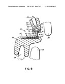 INTRA-ORAL APPLIANCE FOR TREATMENT OF SLEEP DISORDERS diagram and image