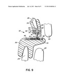 INTRA-ORAL APPLIANCE FOR TREATMENT OF SLEEP DISORDERS diagram and image