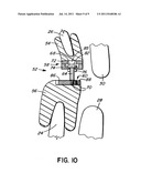 INTRA-ORAL APPLIANCE FOR TREATMENT OF SLEEP DISORDERS diagram and image