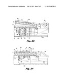 Interlocking Buttress Material Retention System diagram and image