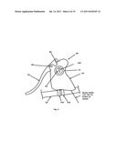 VEHICLE ANTI-THEFT DEVICE diagram and image