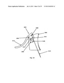 VEHICLE ANTI-THEFT DEVICE diagram and image