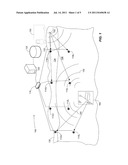 SUBSURFACE INTRUSION DETECTION SYSTEM diagram and image