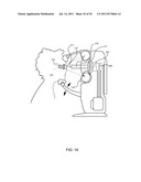 ORTHOVOLTAGE RADIOSURGERY diagram and image