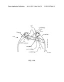 ORTHOVOLTAGE RADIOSURGERY diagram and image