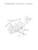 ORTHOVOLTAGE RADIOSURGERY diagram and image