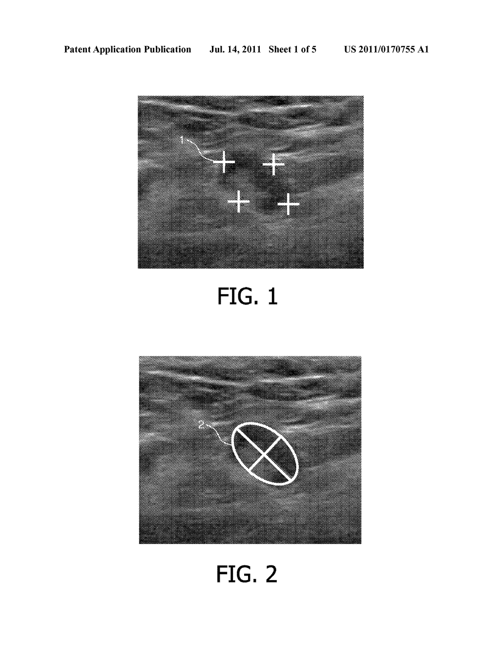 SELECTION OF SNAPSHOTS OF A MEDICAL IMAGE SEQUENCE - diagram, schematic, and image 02