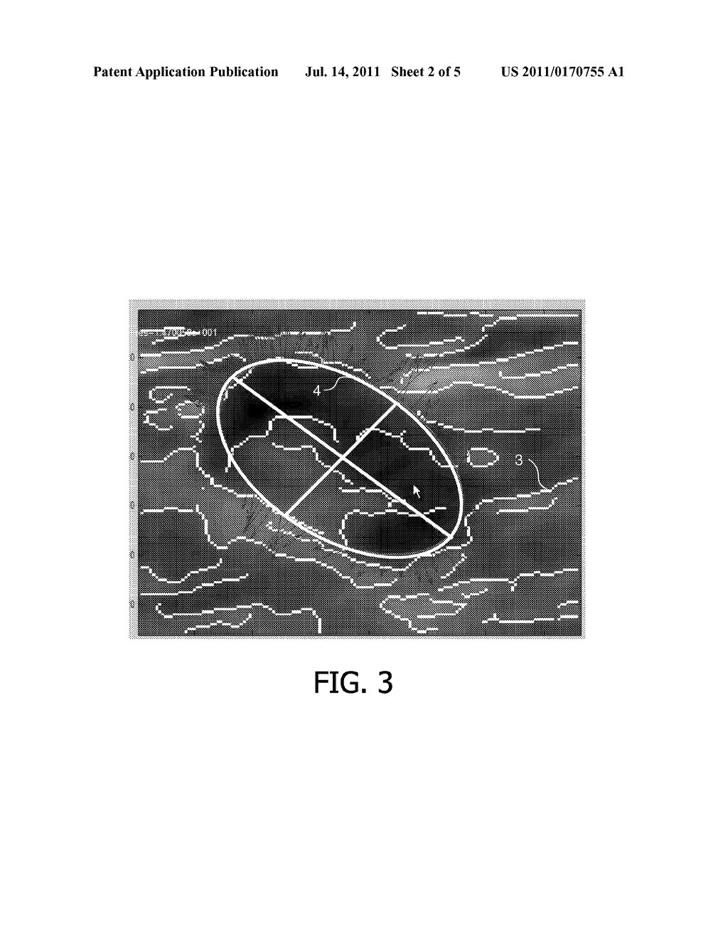 SELECTION OF SNAPSHOTS OF A MEDICAL IMAGE SEQUENCE - diagram, schematic, and image 03