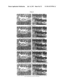 IMAGE REGISTRATION PROCESSING APPARATUS, REGION EXPANSION  PROCESSING     APPARATUS, AND IMAGE QUALITY IMPROVEMENT PROCESSING APPARATUS diagram and image