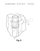 METHODS FOR MODIFYING VASCULAR VESSEL WALLS diagram and image