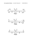 ADDITIONAL STABILIZATION DEVICE FOR ENDO-OSSEOUS DENTAL IMPLANT diagram and image