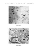 IMPLANTABLE MATERIAL FOR THE REPAIR, AUGMENTATION, OR REPLACEMENT OF BONE     AND A METHOD FOR THE PREPARATION THEREOF diagram and image