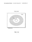 Opto-Acoustic Imaging Devices and Methods diagram and image