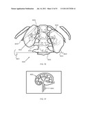 SYSTEMS AND METHODS FOR TREATMENT USING ULTRASONIC ENERGY diagram and image