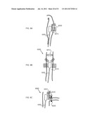 SYSTEMS AND METHODS FOR TREATMENT USING ULTRASONIC ENERGY diagram and image