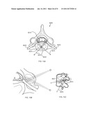 SYSTEMS AND METHODS FOR TREATMENT USING ULTRASONIC ENERGY diagram and image