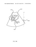 SYSTEMS AND METHODS FOR TREATMENT USING ULTRASONIC ENERGY diagram and image