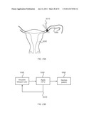 SYSTEMS AND METHODS FOR TREATMENT USING ULTRASONIC ENERGY diagram and image