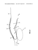 Apparatus and Method for Measuring the Dimensions of the Palpable Surface     of the Prostate diagram and image