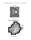 SYSTEM AND METHOD FOR EVALUATING TISSUE diagram and image