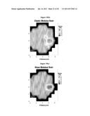 SYSTEM AND METHOD FOR EVALUATING TISSUE diagram and image