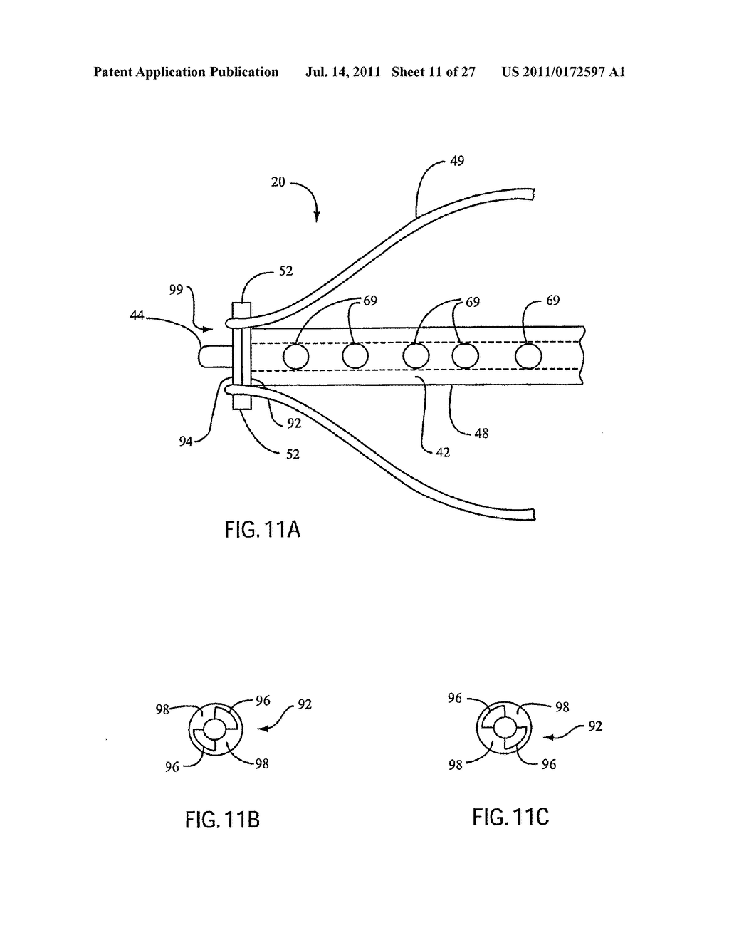 Embolic Protection Device Having Expandable Trap - diagram, schematic, and image 12