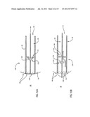 Embolic Protection Device Having Expandable Trap diagram and image