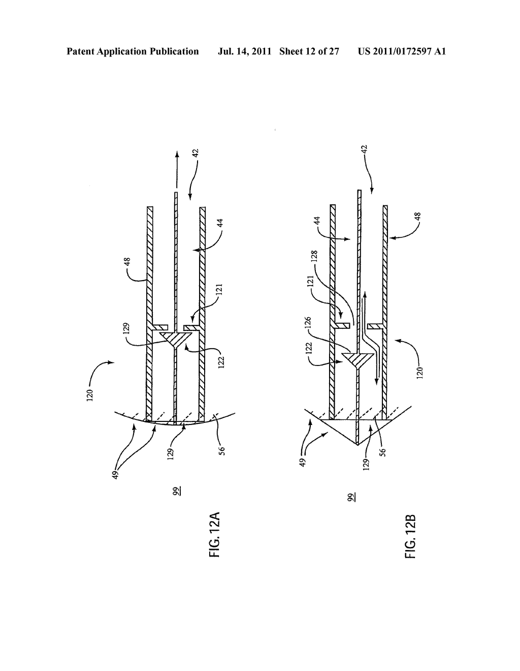 Embolic Protection Device Having Expandable Trap - diagram, schematic, and image 13