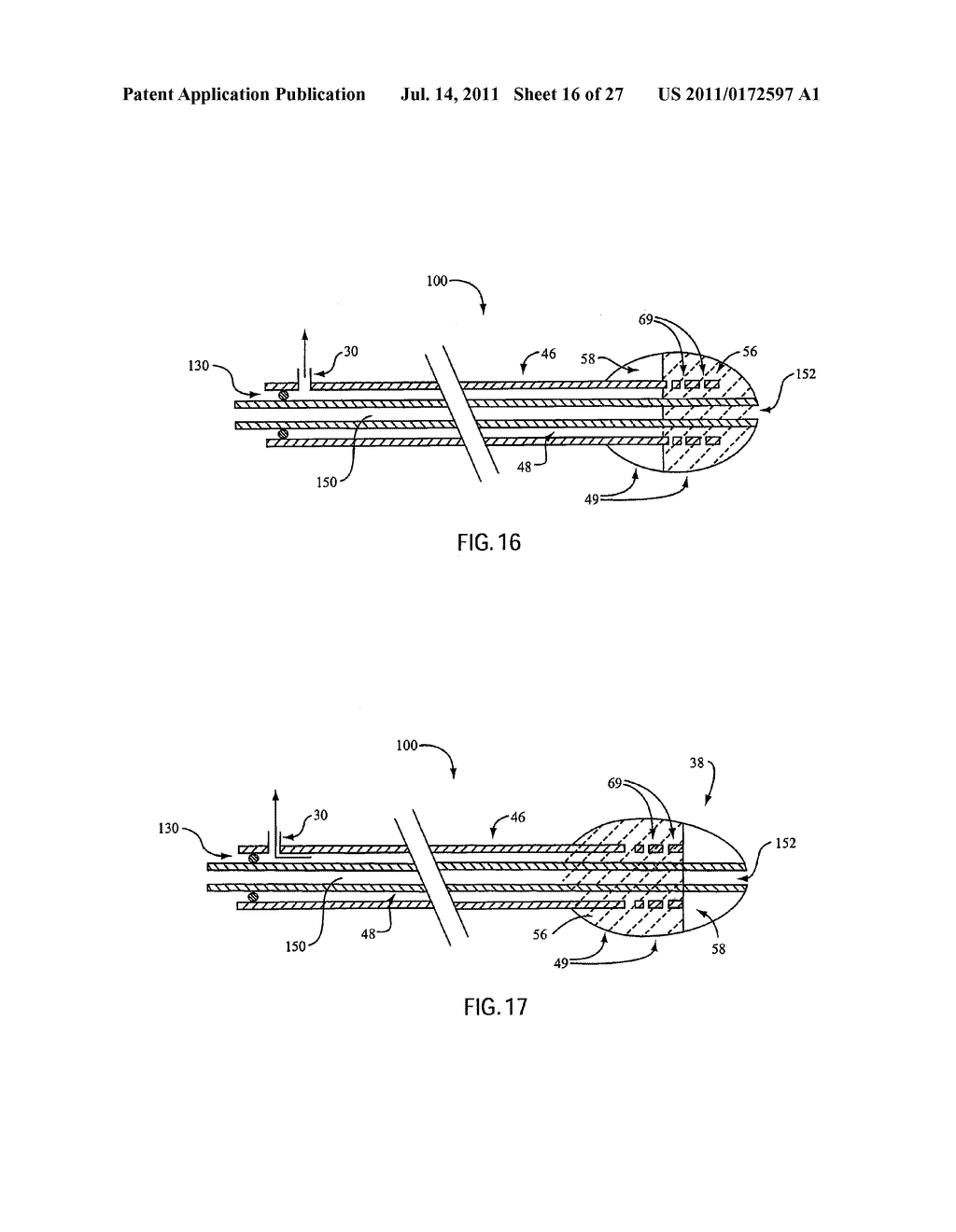 Embolic Protection Device Having Expandable Trap - diagram, schematic, and image 17